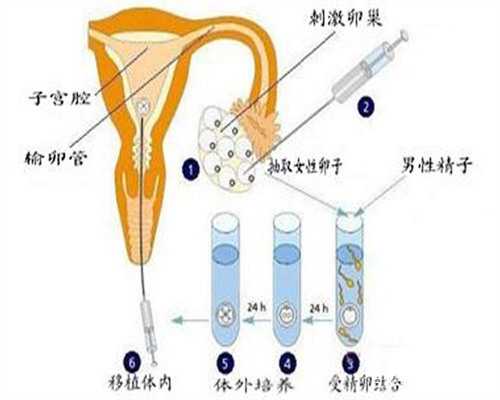 高龄求子路：南京三代试管助孕代怀服务全流程解析