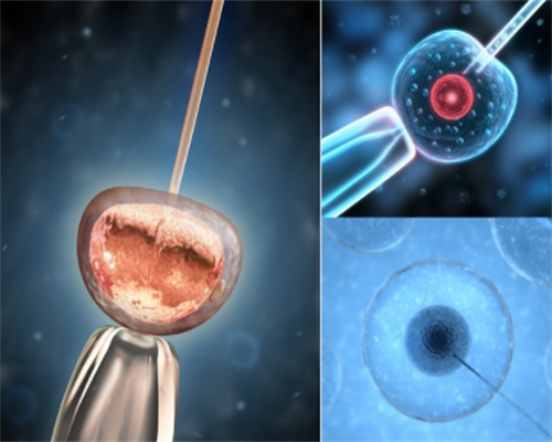 北医三院试管长方案具体详细流程图：不想在医院干等必看